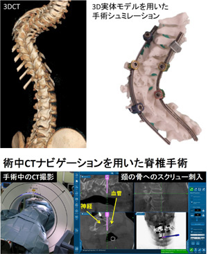 脊椎･脊髄外科グループ