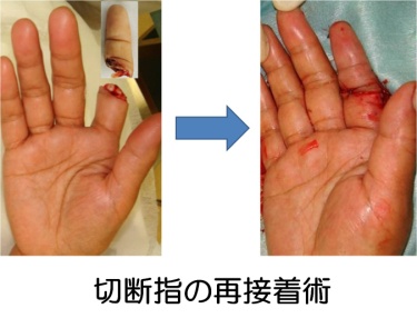外傷