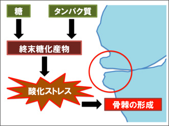 第42回 日本関節病学会　学術集会奨励賞　受賞報告