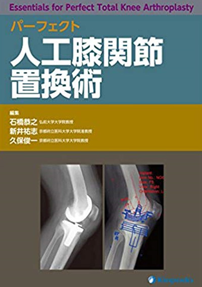 パーフェクト 人工膝関節置換術