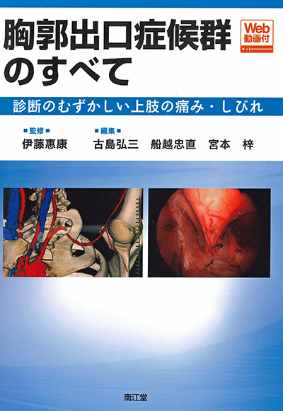 胸郭出口症候群のすべて