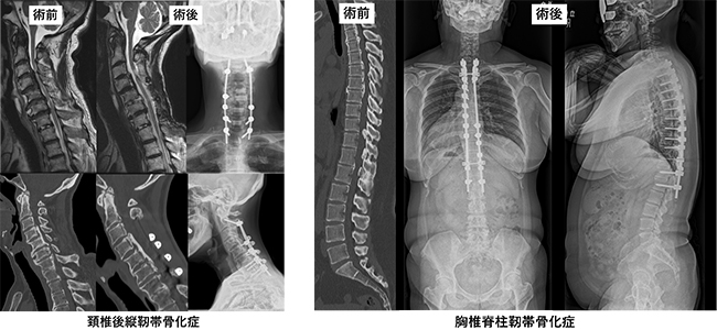 脊椎・脊髄グループ