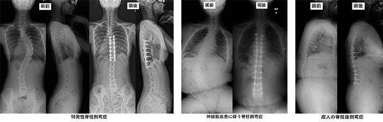 脊椎・脊髄グループ