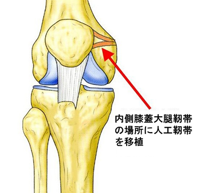 スポーツ整形外科グループ