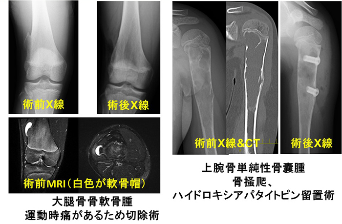 骨・軟部腫瘍グループ